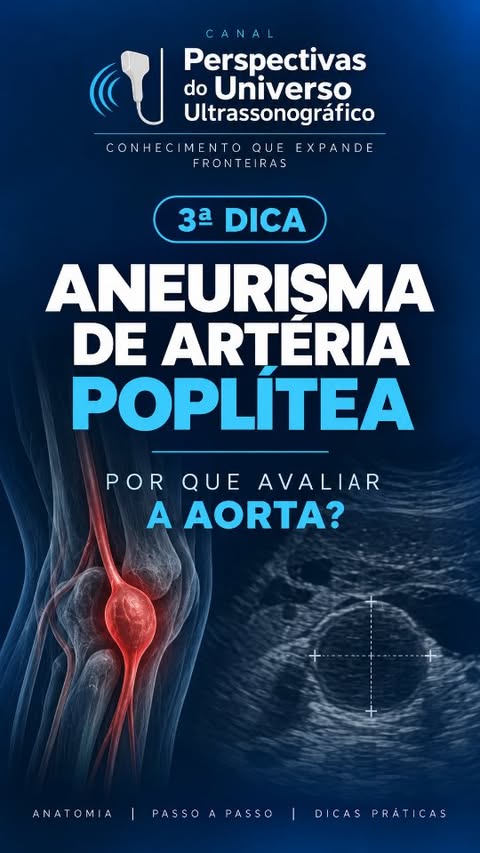 Post sobre aneurisma de artéria poplítea