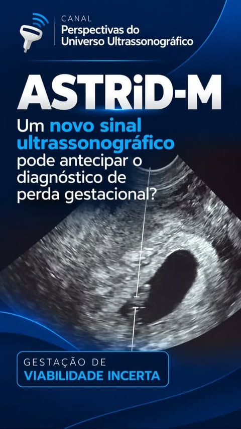 Post sobre um sinal ultrassonográfico de viabilidade no primeiro trimestre
